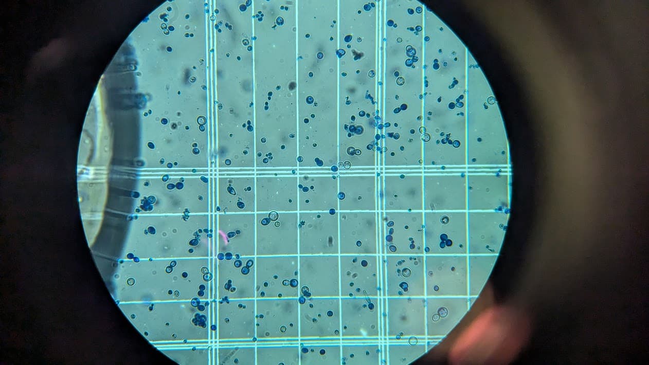 Brewing yeast under a microscope